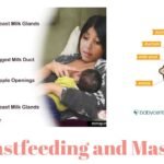 Breastfeeding and Mastitis